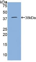 Active Lactoferrin (LTF)