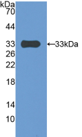 Active Pregnancy Associated Plasma Protein A (PAPPA)