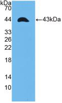 Active Tumor Necrosis Factor Receptor Superfamily, Member 12A (TNFRSF12A)