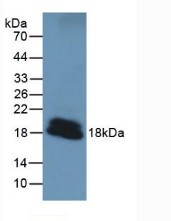 Active Parathyroid Hormone Related Protein (PTHrP)