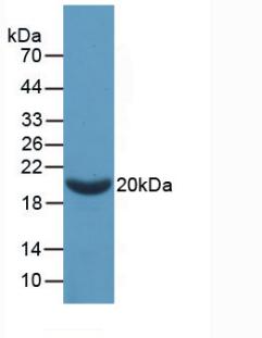 Active Coagulation Factor II (F2)