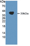 Active Lipoprotein, a (Lpa)