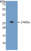 Active Glutathione S Transferase Pi (GSTp)