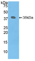 Active Plasminogen (Plg)