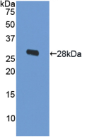 Active Ornithine Decarboxylase (ODC)