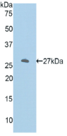 Active Ornithine Decarboxylase (ODC)