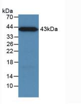 Active Mannose Binding Lectin (MBL)