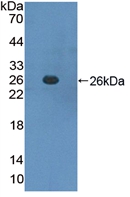 Active Suppressors Of Cytokine Signaling 3 (SOCS3)