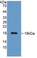 Active Interleukin 6 Receptor (IL6R)