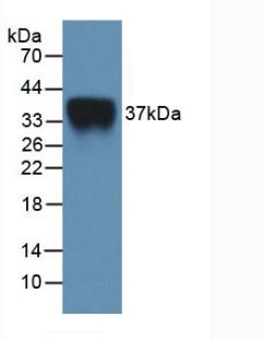 Active Interleukin 2 Receptor Alpha (IL2Ra)