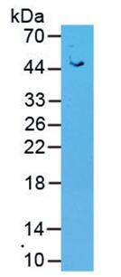 Active Angiotensin I Converting Enzyme 2 (ACE2)