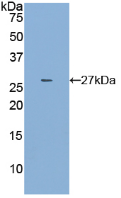 Active Tissue Factor Pathway Inhibitor 2 (TFPI2)