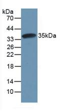 Active Calpain 1 (CAPN1)