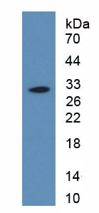 Active Interleukin 34 (IL34)