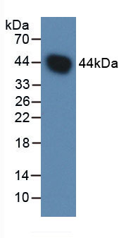 Active Complement Factor B (CFB)