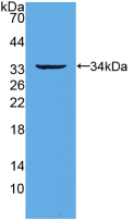 Active Receptor Activator Of Nuclear Factor Kappa B (RANk)