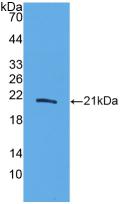 Active Interleukin 20 (IL20)