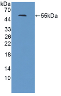 Active Thymidine Kinase 1, Soluble (TK1)