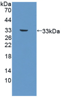 Active Platelet Derived Growth Factor Subunit B (PDGFB)