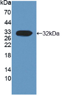 Active Calpain 3 (CAPN3)