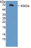 Active Cytochrome P450 1A1 (CYP1A1)