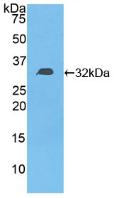 Active Diacylglycerol Kinase Epsilon (DGKe)