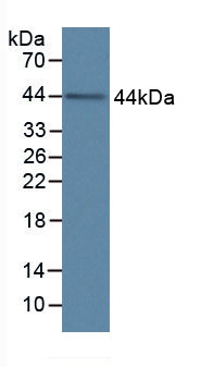 Active Complement Component 1, Q Subcomponent C (C1qC)