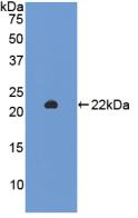 Active Sirtuin 3 (SIRT3)