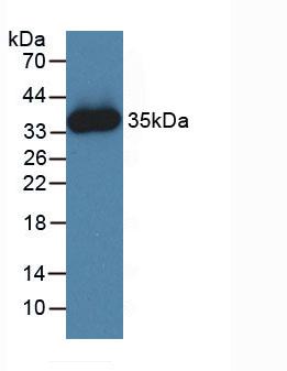 Active Janus Kinase 2 (JAK2)