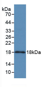 Active Complement Factor H Related Protein 3 (CFHR3)