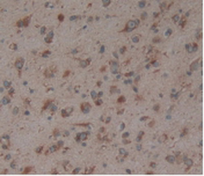 Anti-Calnexin (CNX) Polyclonal Antibody