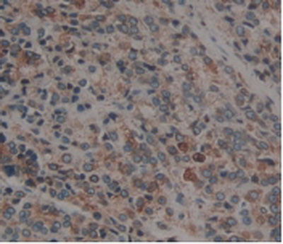 Anti-Calnexin (CNX) Polyclonal Antibody