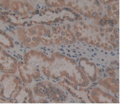 Anti-Calnexin (CNX) Polyclonal Antibody