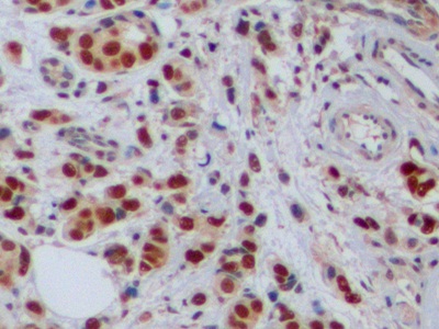 Anti-Proliferating Cell Nuclear Antigen (PCNA) Polyclonal Antibody