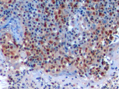 Anti-Proliferating Cell Nuclear Antigen (PCNA) Polyclonal Antibody