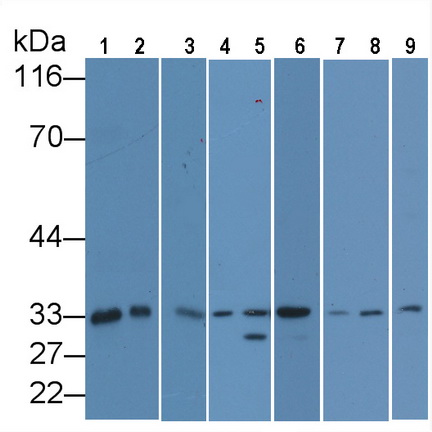 Anti-Proliferating Cell Nuclear Antigen (PCNA) Monoclonal Antibody