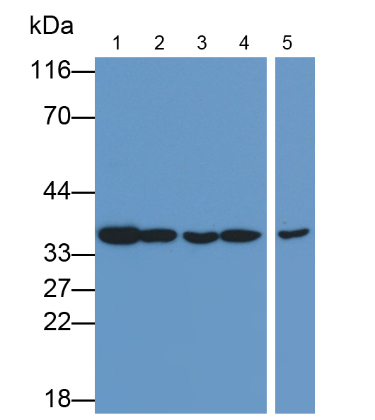 Anti-Proliferating Cell Nuclear Antigen (PCNA) Monoclonal Antibody