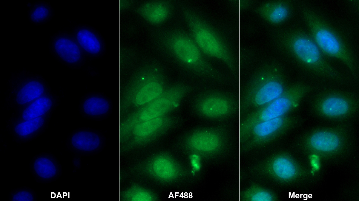 Anti-Cyclophilin A (CYPA) Monoclonal Antibody