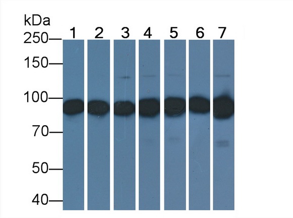 Anti-Beta Catenin (β-catenin) Monoclonal Antibody