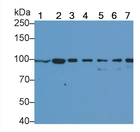 Anti-Beta Catenin (β-catenin) Monoclonal Antibody