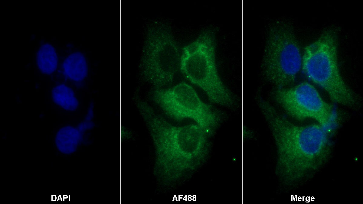 Anti-Transferrin Receptor (TFR) Monoclonal Antibody