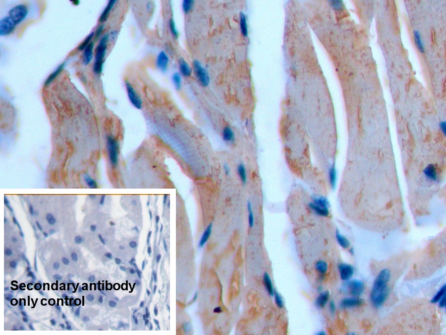 Anti-Actin Alpha 2, Smooth Muscle (ACTa2) Polyclonal Antibody