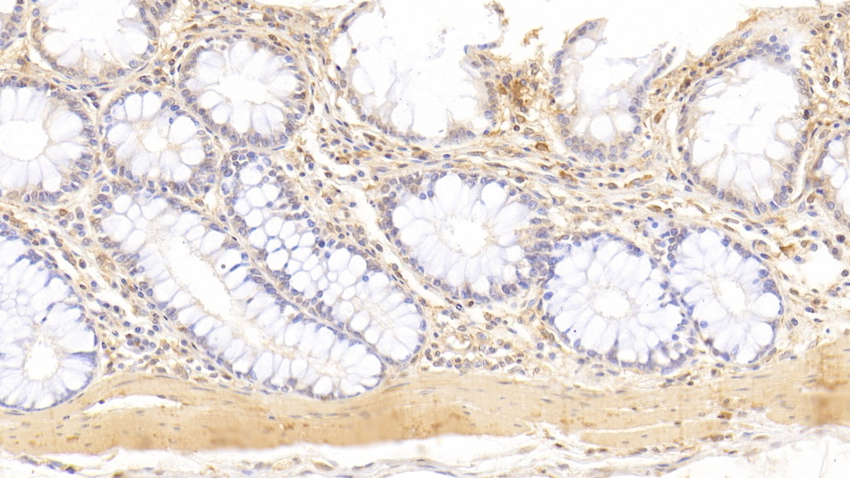 Anti-Actin Alpha 2, Smooth Muscle (ACTa2) Monoclonal Antibody