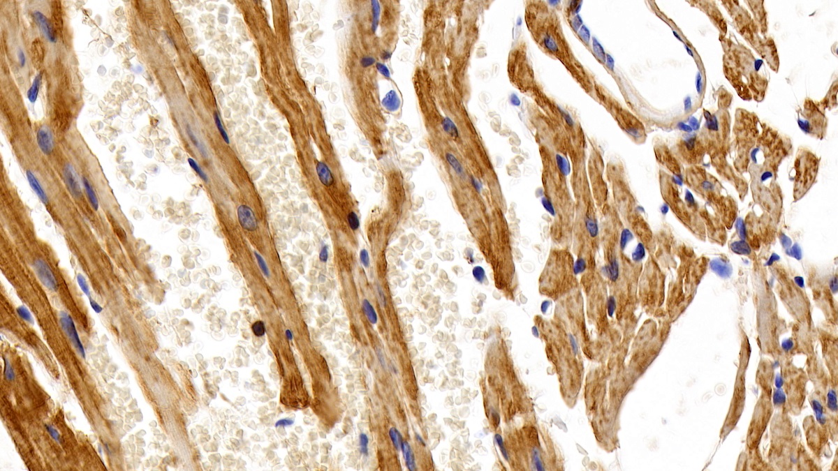 Anti-Actin Alpha 2, Smooth Muscle (ACTa2) Monoclonal Antibody