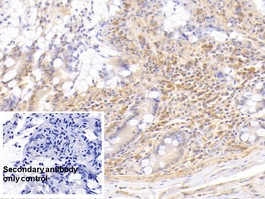 Anti-Actin Alpha 2, Smooth Muscle (ACTa2) Monoclonal Antibody