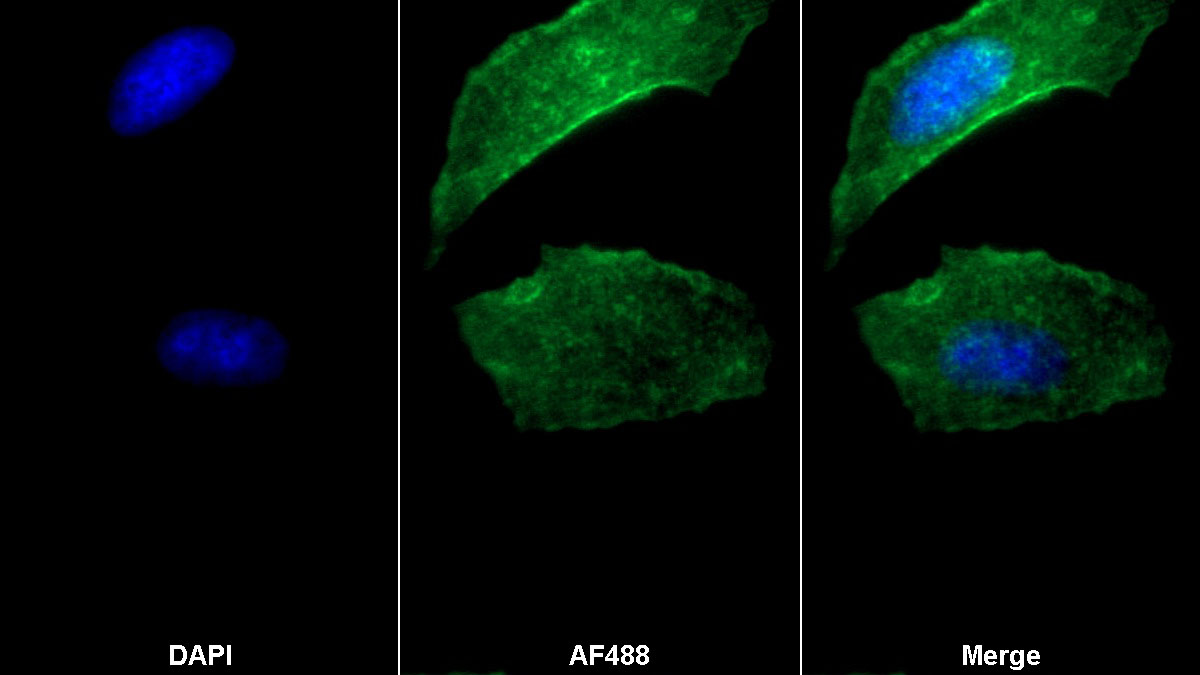 Anti-Actin Alpha 2, Smooth Muscle (ACTa2) Monoclonal Antibody