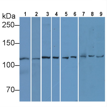 Anti-Vinculin (VCL) Monoclonal Antibody