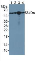 Anti-Tubulin Beta (TUBb) Monoclonal Antibody