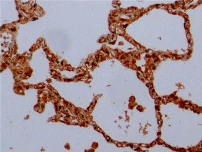 Anti-Tubulin Beta (TUBb) Monoclonal Antibody