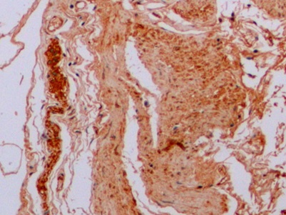 Anti-Tubulin Beta (TUBb) Monoclonal Antibody